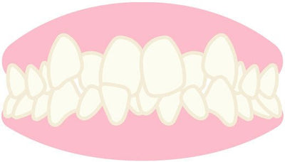 Occlusion Dentaire - Les Bases de Notre Santé - Massilia Dental - Fournitures Matériel Dentaire