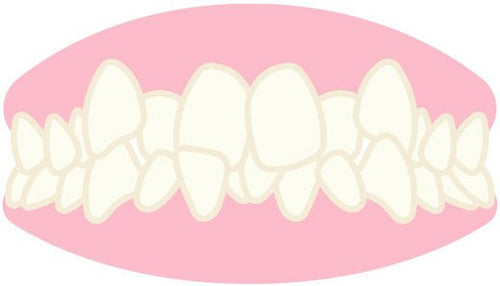 Occlusion Dentaire - Les Bases de Notre Santé - Massilia Dental - Fournitures Matériel Dentaire