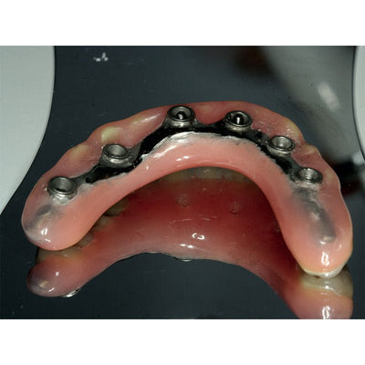 Acrifix Kuss Dental - Seringue 3 gr Résine Photo Rose. - Massilia Dental - Fournitures Matériel Cabinet Dentaire