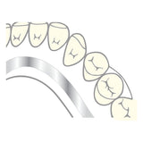 alt="Barre linguale acier renfort résine  10 Pièces - Massilia Dental"