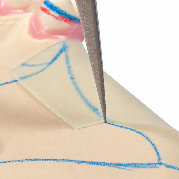 Casting-wax cire espacement duplicata stellite - Renfert