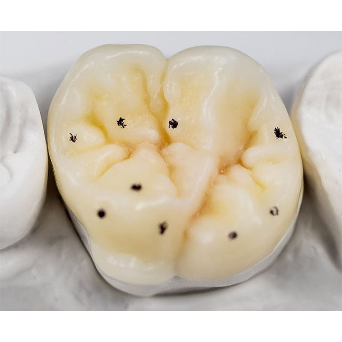 GEO Expert Functional Renfert – Cires de Modelage Wax-up Fonctionnel