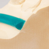 Barres Linguales Renfert Goutte d'Eau Modelage Stellite - Massilia Dental - Fournitures Matériel Cabinet Dentaire