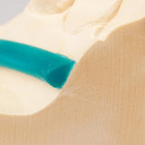 Barres Linguales Renfert Goutte d'Eau Modelage Stellite - Massilia Dental - Fournitures Matériel Cabinet Dentaire