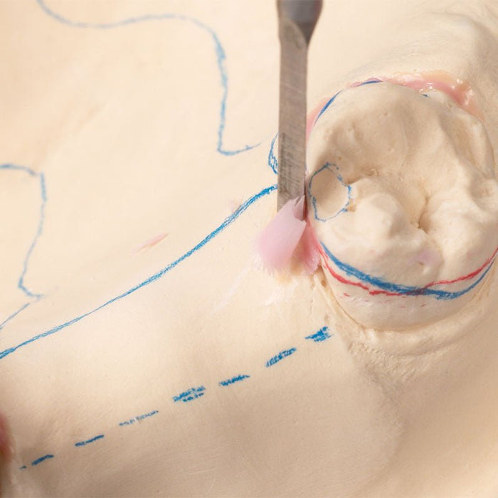 Cire Dépouille Rose Renfert Préparation Duplicata Stellite