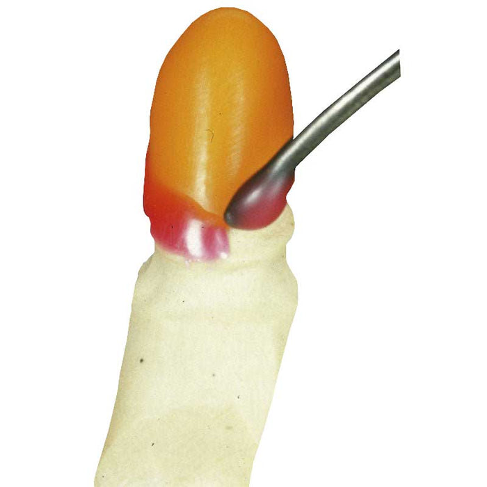 Cire Cervicale Al Dente Sous Couche Céramiques Pressées.