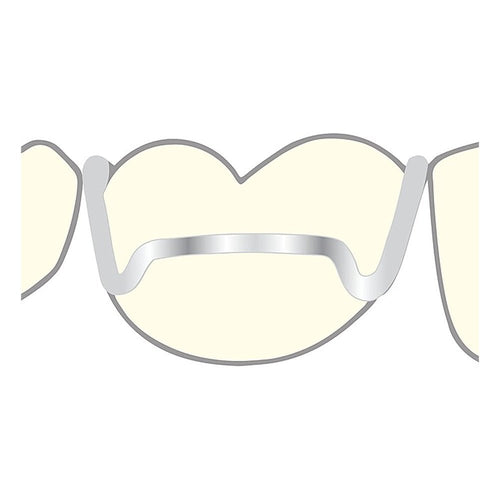 Crochets Adams Préformés - Ajustage Appareil Orthodontie. - Massilia Dental - Fournitures Matériel Cabinet Dentaire