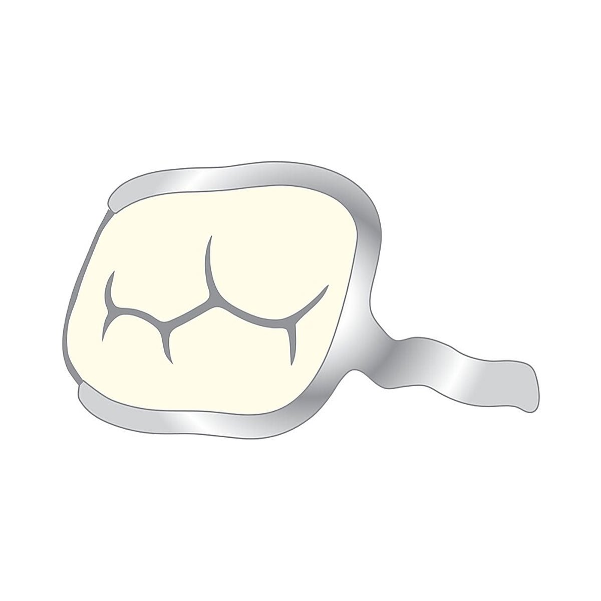Crochet O Sans Taquet Molaire - Scheu Dental