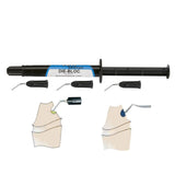 Die - bloc Yeti - Pâte Comblement Photopolymérisable. - Massilia Dental - Fournitures Matériel Cabinet Dentaire