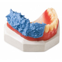 Flexistone Plus silicone A protection dents mises en moufle modèle