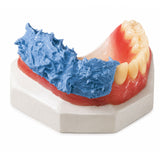 Flexistone Plus silicone A protection dents mises en moufle modèle