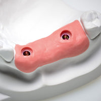 alt=Zhermack Gingifast Rigid 2×50 ml -  finishing the gingival mask on a plaster impression"