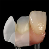 Zirconia Coloring Liquid Coloration avant Frittage Recharge - Massilia Dental - Fournitures Matériel Cabinet Dentaire
