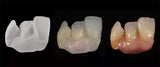 Zirconia Coloring Liquid Coloration avant Frittage Recharge - Massilia Dental - Fournitures Matériel Cabinet Dentaire