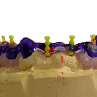 Kiero - Form Gel Modelage Résine Photo Fraisage Fixation Soudure - Massilia Dental - Fournitures Matériel Cabinet Dentaire