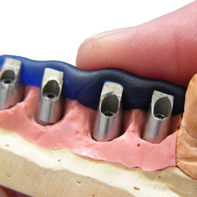 Kieroplast résine calcinable réalisation clé positionnement implants
