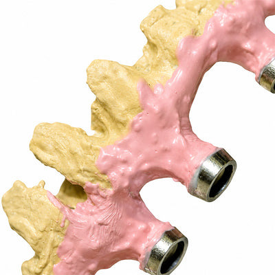 Kierolink opaquer rose poudre liaison métal résine sur bridge implants