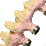 Kiero - link Liquide Opaquer Poudre Liaison Métal Résine - Massilia Dental - Fournitures Matériel Cabinet Dentaire