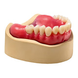 Elite LC Tray Round Plaques Photo Rose - Base dure Montage - Massilia Dental - Fournitures Matériel Cabinet Dentaire