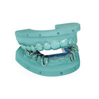 Résine Dima Print Stone Kulzer impression modèles ortho vert