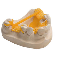 VarseoWax Cast – Résine 3D Calcinable Jaune - Massilia Dental - Fournitures Matériel Cabinet Dentaire
