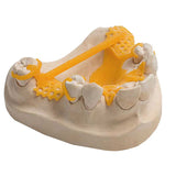VarseoWax Cast – Résine 3D Calcinable Jaune - Massilia Dental - Fournitures Matériel Cabinet Dentaire