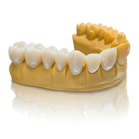 alt="VarseoSmile Temp – Résine 3D couronnes bridges provisoires imprimées - Massilia Dental"