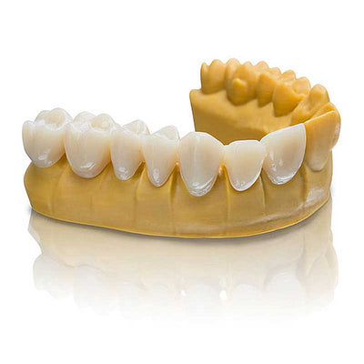alt="VarseoSmile Temp – Résine 3D couronnes bridges provisoires imprimées - Massilia Dental"