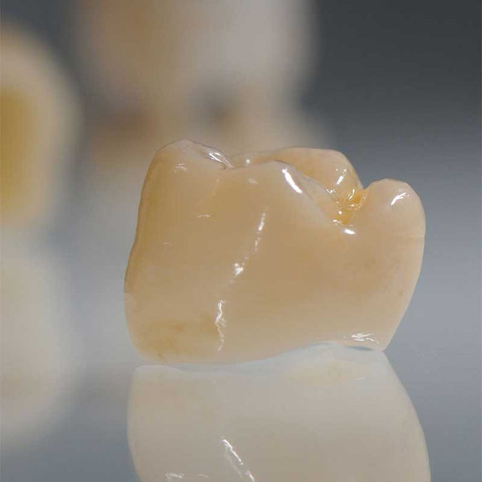 Resina 3D VarseoSmile Crown Plus per corone definitive
