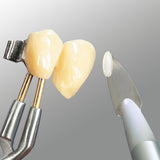 Ergo - Acryl Spatule Composite Renfert - Modelage Pâte. - Massilia Dental - Fournitures Matériel Cabinet Dentaire