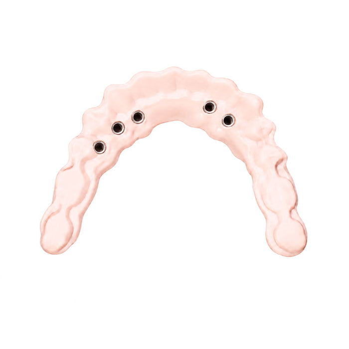 Trilor rose disque fibre de verre armature implantaire sans métal 