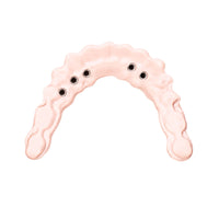 Trilor rose disque fibre de verre armature implantaire sans métal 