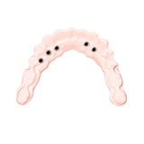 Trilor rose disque fibre de verre armature implantaire sans métal 