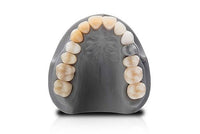 VarseoSmile TriniQ BEGO – Résine 3D dentaire définitive