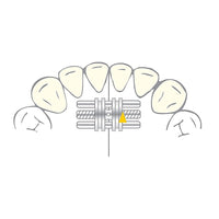 Vector 100 mini vérin ortho - Scheu Dental 10  pièces shema
