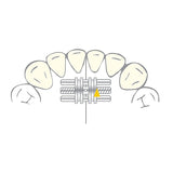 Vector 100 mini vérin ortho - Scheu Dental 10  pièces shema