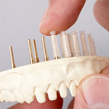 Profix Pins Précision Renfert - Gaine Plastique Easy - Glide - Massilia Dental - Fournitures Matériel Cabinet Dentaire